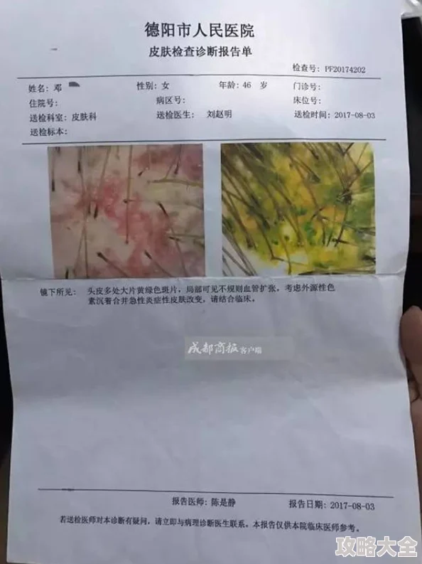 sp发刷红肿双丘旧巷笙歌旧疾复发引发担忧多方寻医问药未果